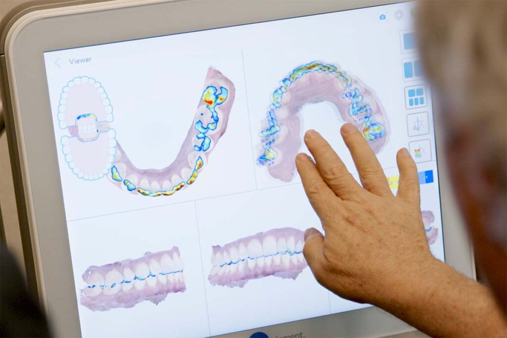 Kelleher-Orthodontics-offers-advanced-3d-imagery-to-patients-from-west-sacramento Kelleher-Orthodontics-offers-advanced-3d-imagery-to-patients-from-west-sacramento