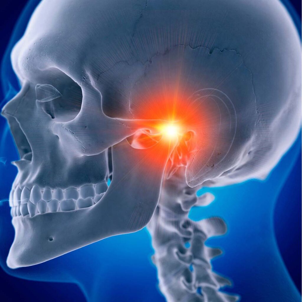 Illustration of the Temporomandibular joint highlighting where the orthodontist can relieve pain