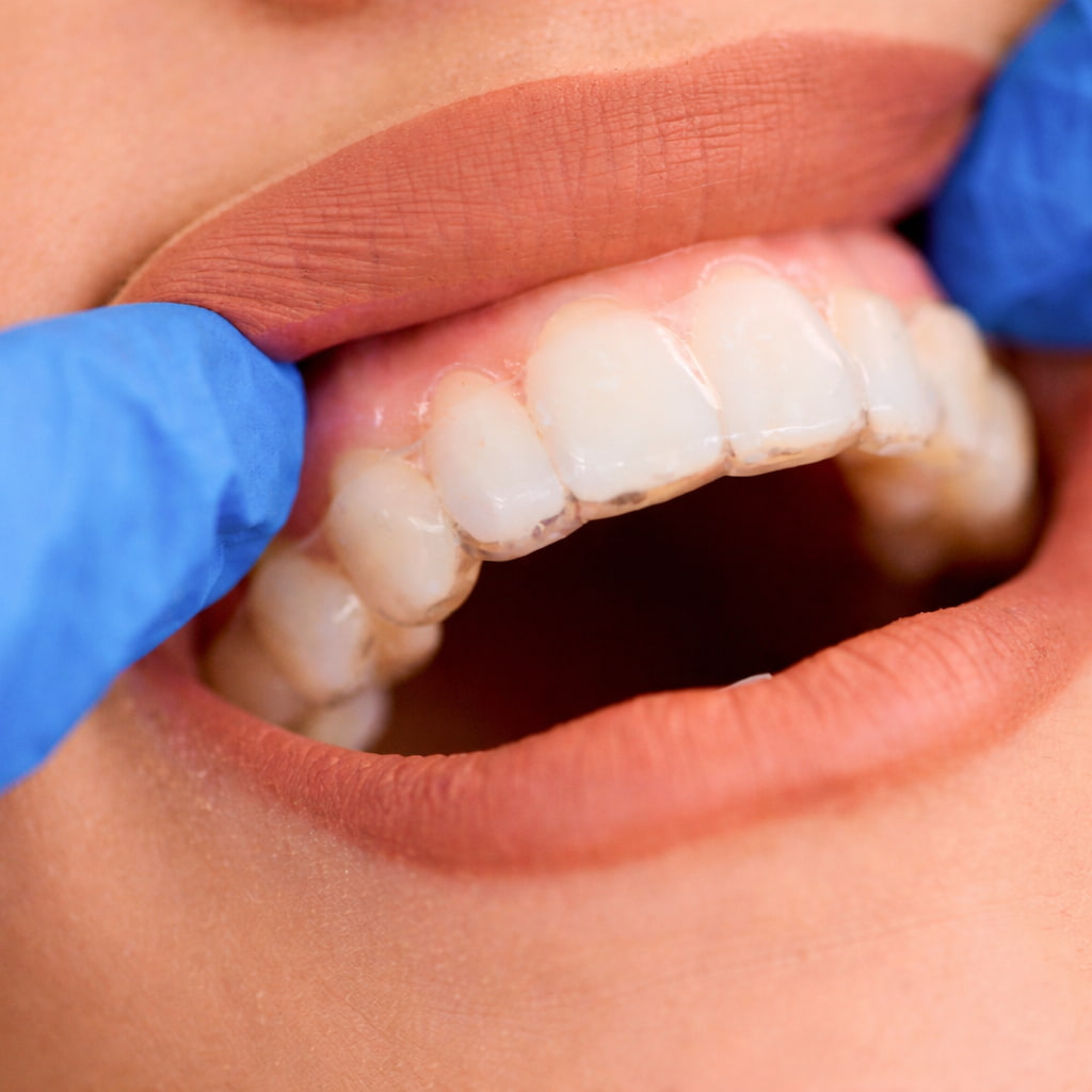 Teens sitting on cement steps watching a friend skateboard and smiling at the park in Folsom